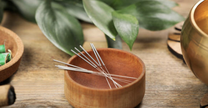 Acupuncture and Migraines: How This Ancient Practice Can Help image